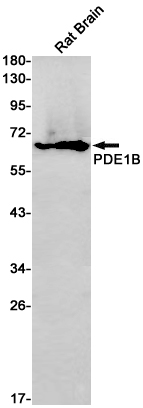 Western blot detection of PDE1B in Rat Brain lysates using PDE1B Rabbit pAb(1:1000 diluted).Predicted band size:61kDa.Observed band size:61kDa.