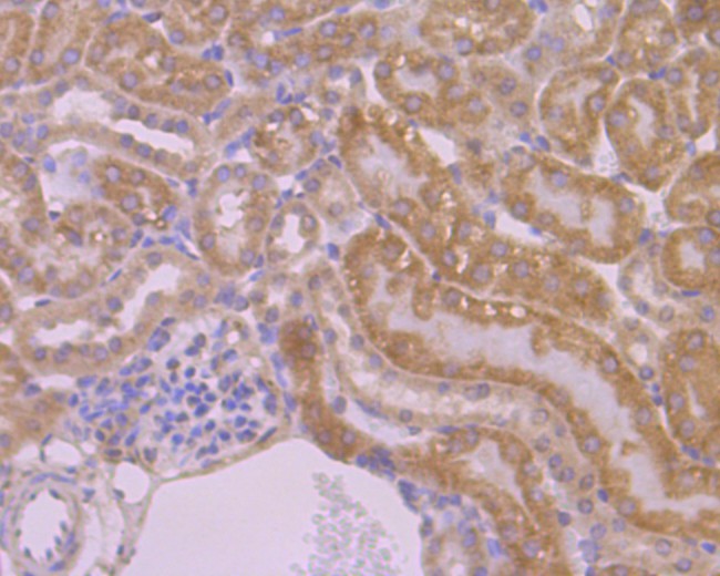 Fig4: Immunohistochemical analysis of paraffin-embedded mouse liver tissue using anti-APR3 antibody. Counter stained with hematoxylin.