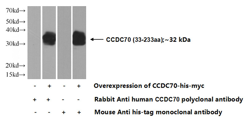 Transfected HEK-293 cells were subjected to SDS PAGE followed by western blot with Catalog No:108986(CCDC70 Antibody) at dilution of 1:2500