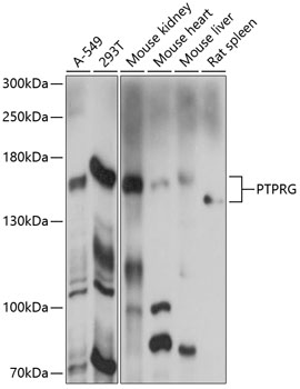 Western blot - PTPRG Polyclonal Antibody 