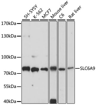 Western blot - SLC6A9 Polyclonal Antibody 