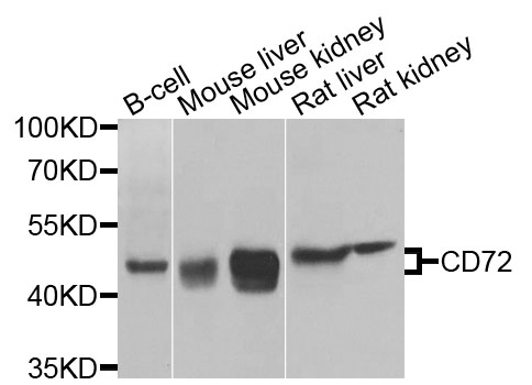 Western blot - CD72 Polyclonal Antibody 