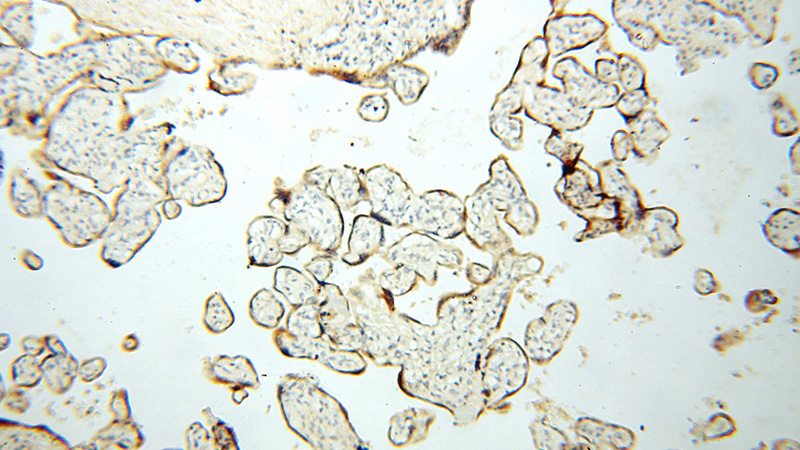 Immunohistochemical of paraffin-embedded human placenta using Catalog No:109682(CYP19A1 antibody) at dilution of 1:50 (under 10x lens)
