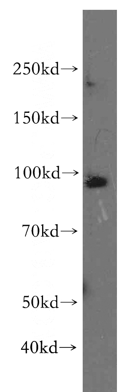 HeLa cells were subjected to SDS PAGE followed by western blot with Catalog No:117206(MYBL2 antibody) at dilution of 1:300