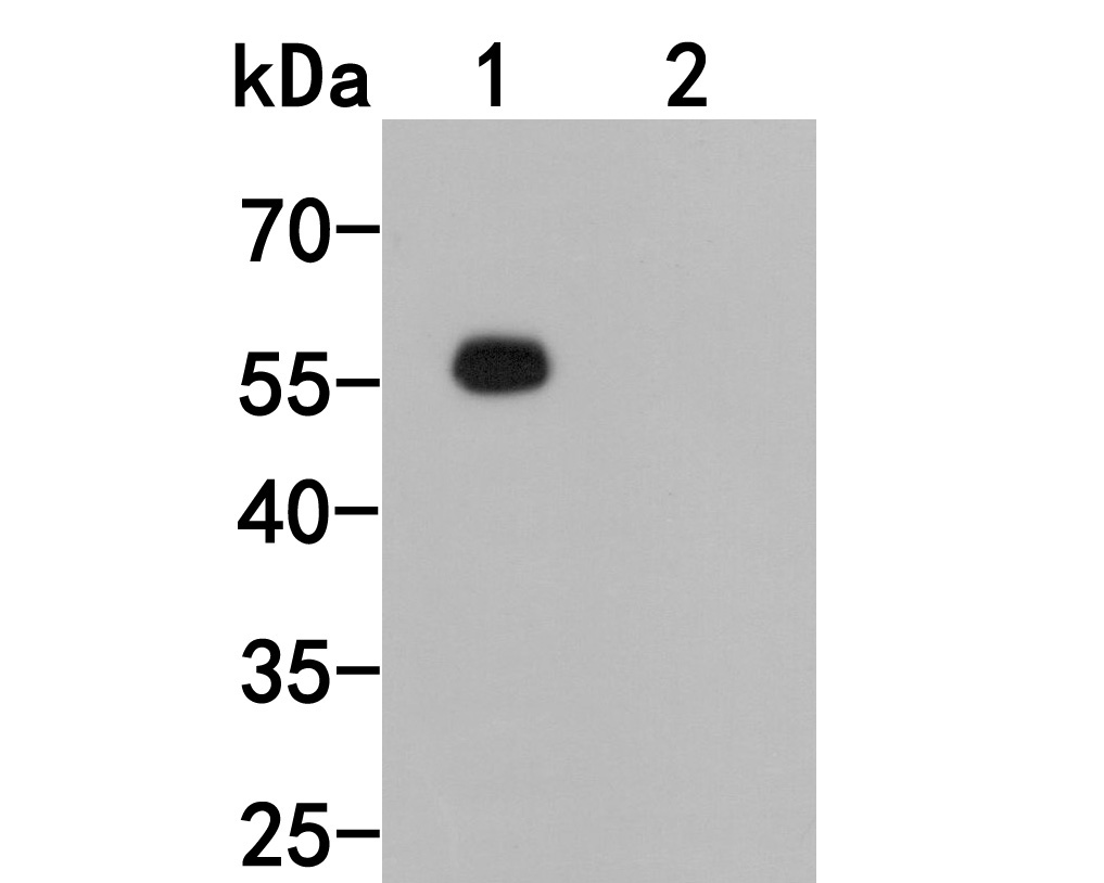 Fig1:; Western blot analysis of Mouse anti-Human IgG on Human IgG protein. Proteins were transferred to a PVDF membrane and blocked with 5% NFTM/TBST in PBS for 1 hour at room temperature. The primary antibody ( 1ug/ml) was used in 5% NFTM/TBST at room temperature for 2 hours. Goat Anti-Mouse IgG - HRP Secondary Antibody (HA1006) at 1:20,000 dilution was used for 1 hour at room temperature.; Positive control:; Lane 1: Human IgG protein; Lane 2: Human IgM protein; This antibody does not cross-react with the human IgM protein.