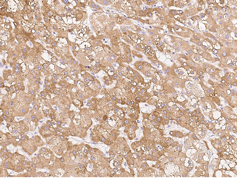 Human CLPTM1L Immunohistochemistry(IHC) 15455