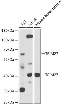 Western blot - TRIM27 Polyclonal Antibody 