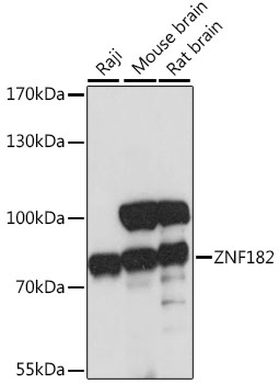 Western blot - ZNF182 Polyclonal Antibody 