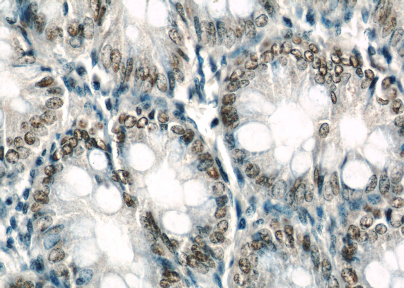 Immunohistochemical of paraffin-embedded human colon using Catalog No:111092(N-PAC antibody) at dilution of 1:50 (under 40x lens)