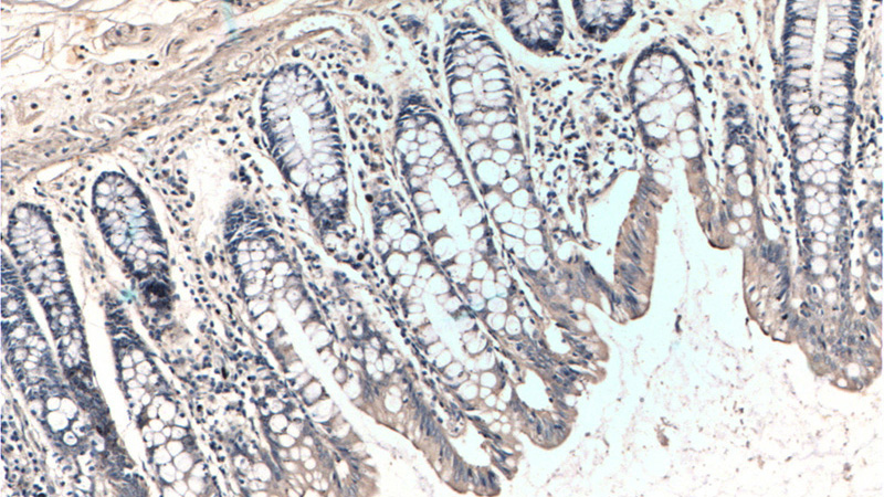 Immunohistochemistry of paraffin-embedded human colon tissue slide using Catalog No:109341(Claudin 3 Antibody) at dilution of 1:100 (under 10x lens).