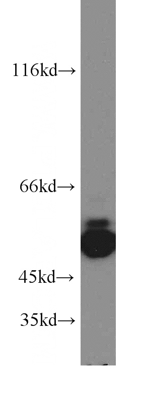 human brain tissue were subjected to SDS PAGE followed by western blot with Catalog No:108190(ARHGEF9-Specific antibody) at dilution of 1:200
