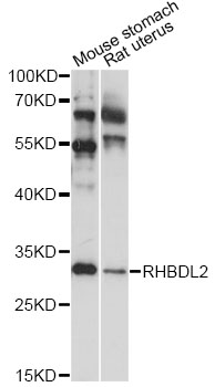 Western blot - RHBDL2 Polyclonal Antibody 