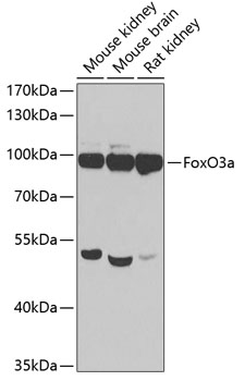 Western blot - FoxO3a Polyclonal Antibody 