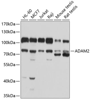 Western blot - ADAM2 Polyclonal Antibody 