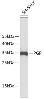 Western blot - PGP Polyclonal Antibody 