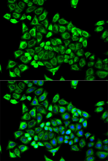 Immunofluorescence - CDA Polyclonal Antibody 