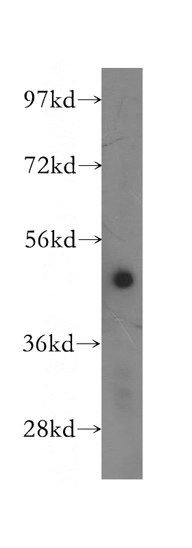 human brain tissue were subjected to SDS PAGE followed by western blot with Catalog No:108117(AP1M1 antibody) at dilution of 1:400
