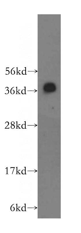 human brain tissue were subjected to SDS PAGE followed by western blot with Catalog No:114750(RNF2 antibody) at dilution of 1:300