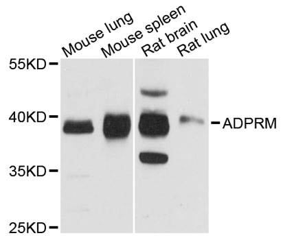 Western blot - ADPRM Polyclonal Antibody 