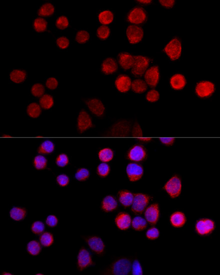 Immunofluorescence - SLC25A17 Polyclonal Antibody 