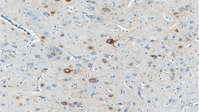 Immunohistochemistry of paraffin-embedded human brain tissue slide using Catalog No:113149(NEFH Antibody) at dilution of 1:200 (under 10x lens)