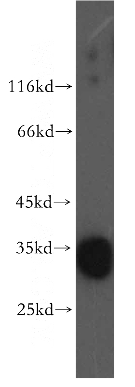 mouse skeletal muscle tissue were subjected to SDS PAGE followed by western blot with Catalog No:109958(DNASE1L1 antibody) at dilution of 1:1000