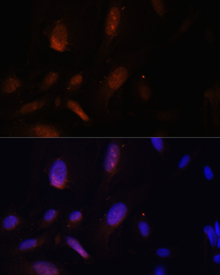 Immunofluorescence - ZNF574 Polyclonal Antibody 