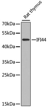 Western blot - IFI44 Polyclonal Antibody 