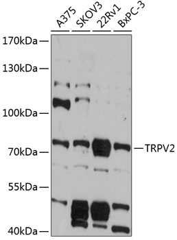 Western blot - TRPV2 Polyclonal Antibody 