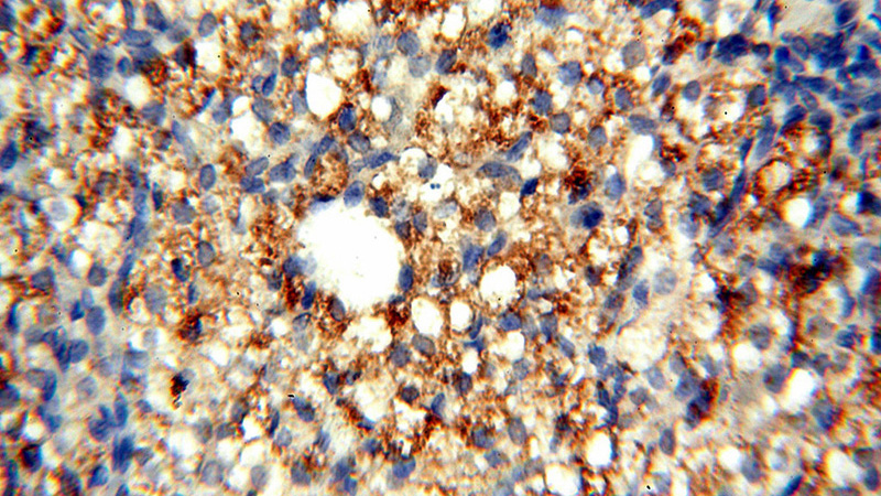 Immunohistochemical of paraffin-embedded human ovary using Catalog No:116461(TYW1B antibody) at dilution of 1:50 (under 40x lens)