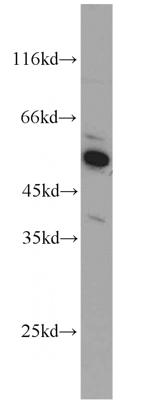 HepG2 cells were subjected to SDS PAGE followed by western blot with Catalog No:108099(ANXA8 antibody) at dilution of 1:100