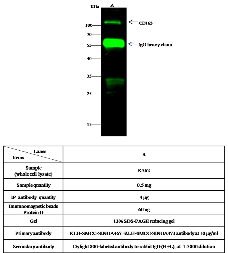 CD163 Antibody, Rabbit PAb, Antigen Affinity Purified, Immunoprecipitation
