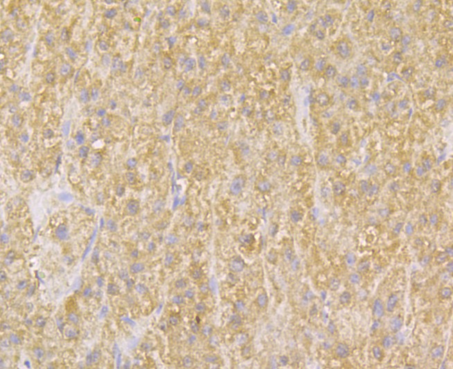 Fig3: Immunohistochemical analysis of paraffin-embedded human liver tissue using anti-TMEM2 antibody. Counter stained with hematoxylin.