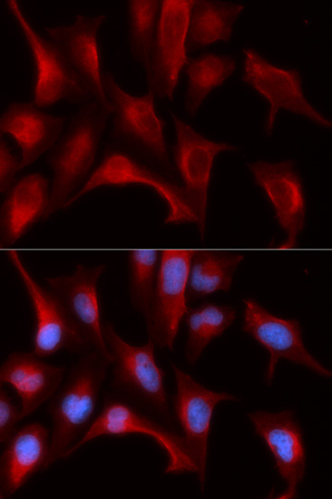 Immunofluorescence - PSMB4 Polyclonal Antibody 