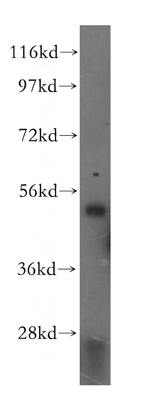 HepG2 cells were subjected to SDS PAGE followed by western blot with Catalog No:115659(SQRDL antibody) at dilution of 1:500