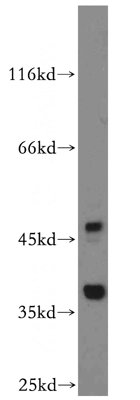 HepG2 cells were subjected to SDS PAGE followed by western blot with Catalog No:116421(TRUB2 antibody) at dilution of 1:500