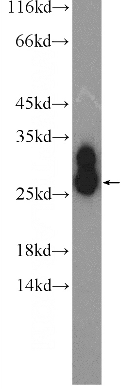 human plasma tissue were subjected to SDS PAGE followed by western blot with Catalog No:111632(IGJ Antibody) at dilution of 1:1000