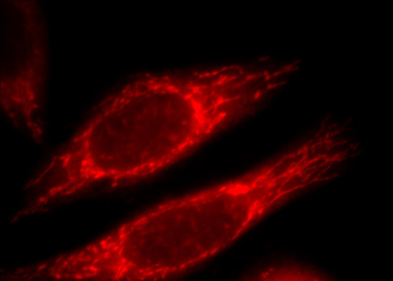 Immunofluorescent analysis of Hela cells, using TRAP1 antibody Catalog No:116338 at 1:25 dilution and Rhodamine-labeled goat anti-rabbit IgG (red).