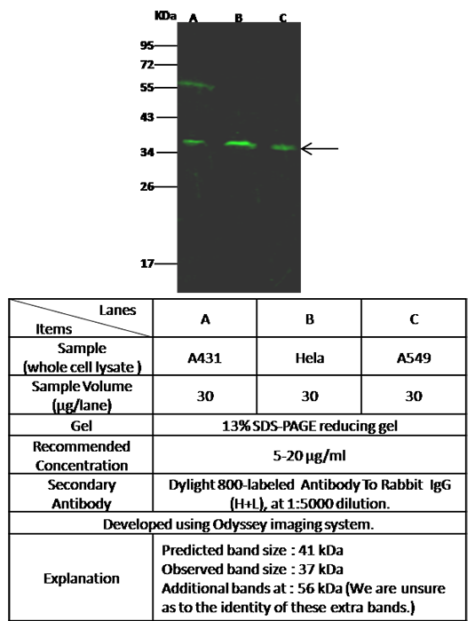 Human ARPC1B/ARP2/3 subunit 1B Western blot (WB) 15169