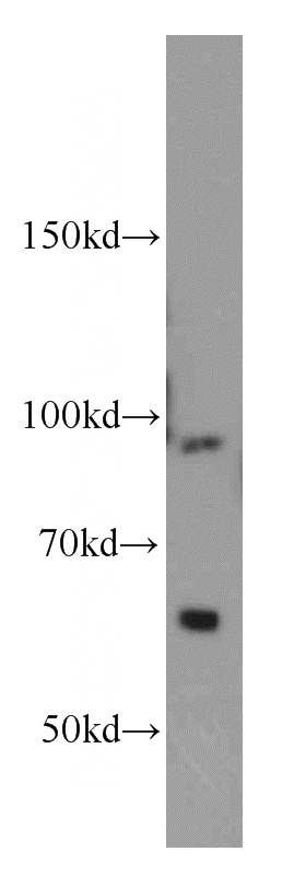 HeLa cells were subjected to SDS PAGE followed by western blot with Catalog No:116014(TFIP11 antibody) at dilution of 1:500