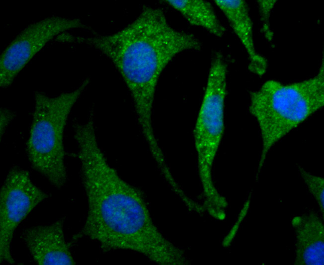 Fig3: ICC staining IL19 in SH-SY5Y cells (green). The nuclear counter stain is DAPI (blue). Cells were fixed in paraformaldehyde, permeabilised with 0.25% Triton X100/PBS.