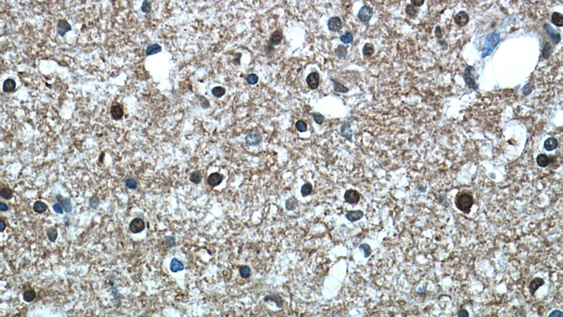 Immunohistochemical of paraffin-embedded human brain using Catalog No:115985(TAF1-Specific antibody) at dilution of 1:100 (under 40x lens)