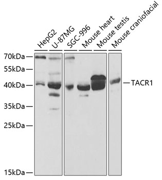 Western blot - TACR1 Polyclonal Antibody 