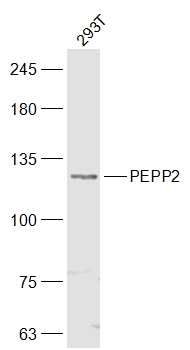 Fig1: Sample:; 293T(Human) Cell Lysate at 30 ug; Primary: Anti-PEPP2 at 1/300 dilution; Secondary: IRDye800CW Goat Anti-Rabbit IgG at 1/20000 dilution; Predicted band size: 127 kD; Observed band size: 127 kD