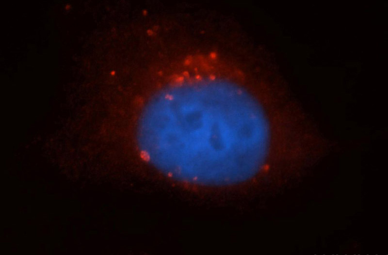 Immunofluorescent analysis of Hela cells, using RUFY1 antibody Catalog No:114868 at 1:50 dilution and Rhodamine-labeled goat anti-rabbit IgG (red). Blue pseudocolor = DAPI (fluorescent DNA dye).