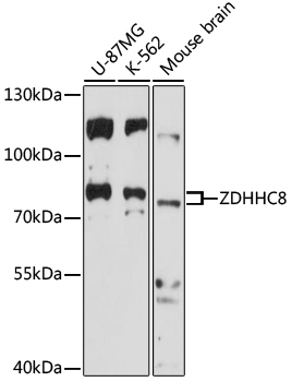 Western blot - ZDHHC8 Polyclonal Antibody 