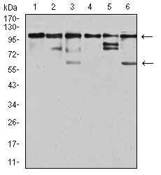 Fig3: Western blot analysis of ZFP91 on different cell lysate using anti-ZFP91 antibody at 1/1,000 dilution.; Positive control:; Lane 1: Jurkat; Lane 2: A431; Lane 3: HepG2; Lane 4: HEK293; Lane 5: A549; Lane 6: PC-3
