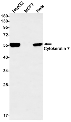 Western blot detection of Cytokeratin 7 in HepG2,MCF7(negative for Keratin 7,as expected),Hela cell lysates using Cytokeratin 7 Rabbit mAb(1:500 diluted).Predicted band size:51kDa.Observed band size:51kDa.