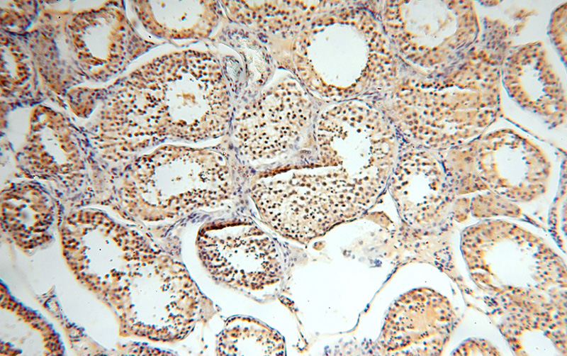 Immunohistochemical of paraffin-embedded human testis using Catalog No:108951(CC2D1A antibody) at dilution of 1:100 (under 10x lens)