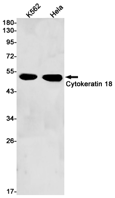Western blot detection of Cytokeratin 18 in K562,Hela cell lysates using Cytokeratin 18 Rabbit pAb(1:1000 diluted).Predicted band size:48kDa.Observed band size:48kDa.